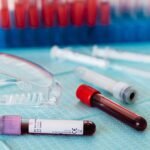 O Óleo de Cânhamo pode melhorar o bom colesterol do sangue