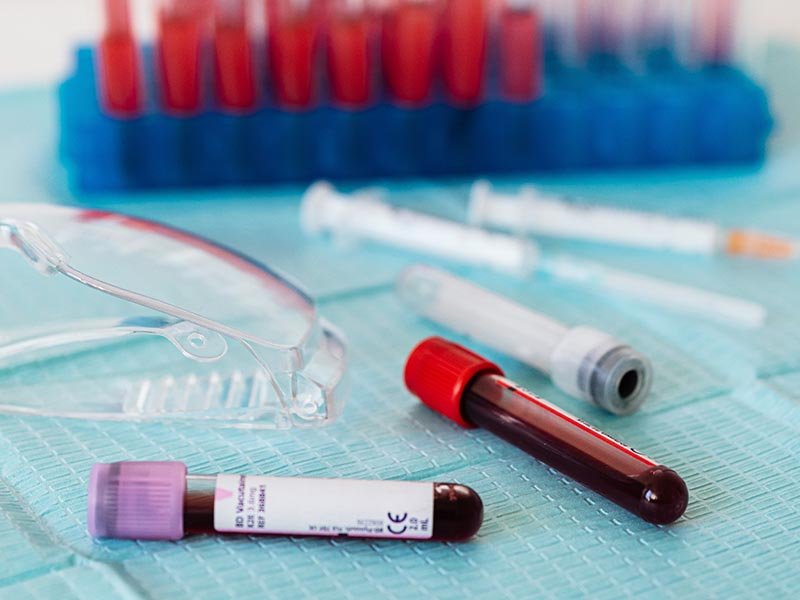 Read more about the article O Óleo de Cânhamo pode melhorar o bom colesterol do sangue
